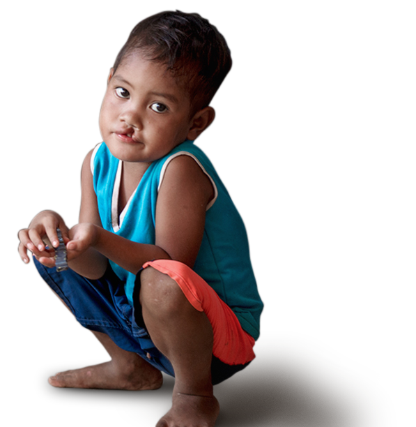A child with a cleft condition squatting on the ground