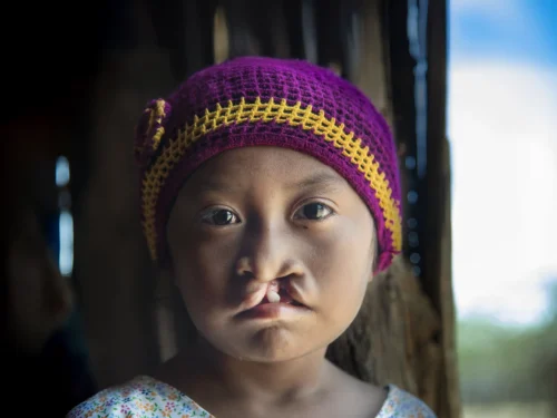 A girl wearing a purple hat looks into the camera
