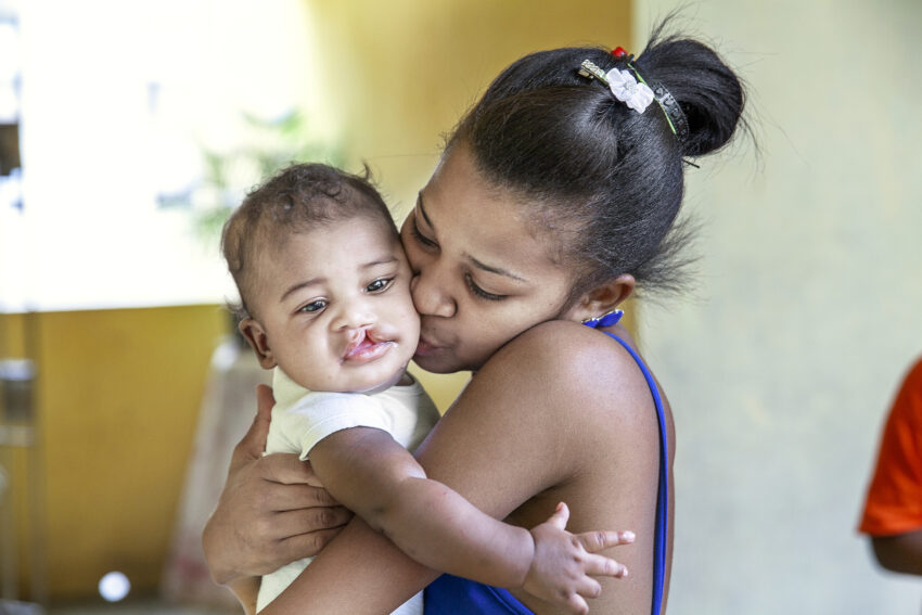 Mother holding her baby boy who was born with a cleft lip while kissing him on the cheek