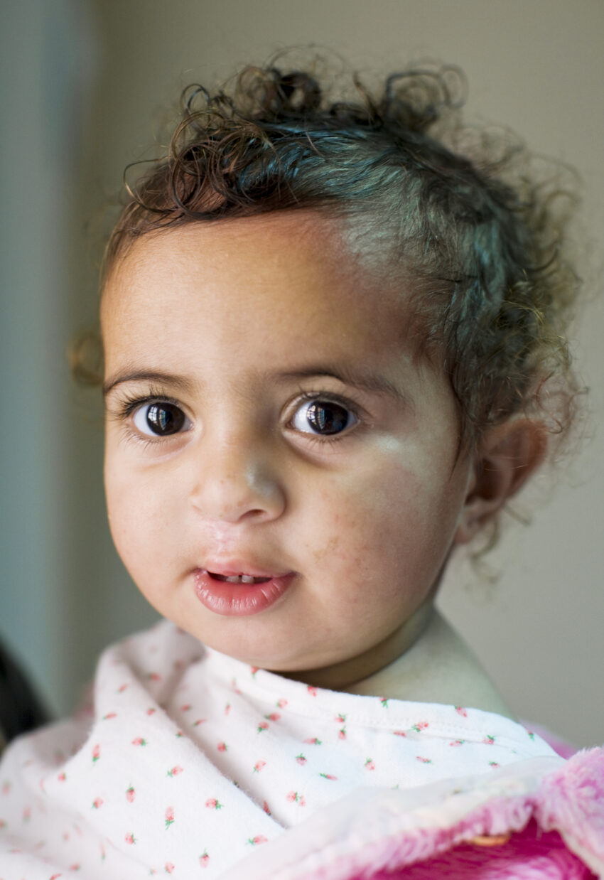 Little girl with short curly hair in hospital gown looking forward .