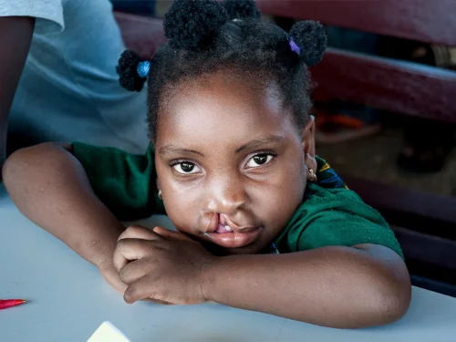 amata Abubakari, Female, 4 years 8 months old