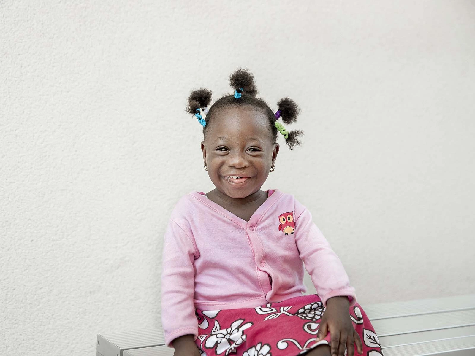 Jocelyn from Ghana, after her cleft lip surgery.