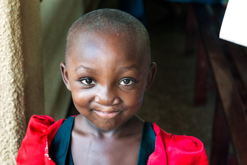Deborah Female, 4 years old. BCL after, approved. 2011 number was 118. Operation Smile medical team Ghana.