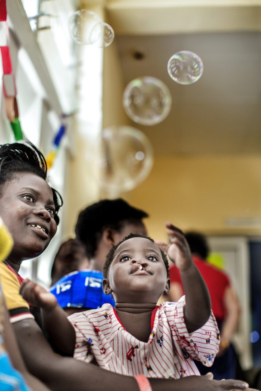 A child with a cleft lip looks up at bubbles.