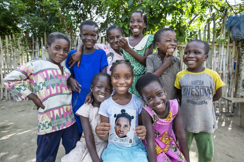 A group of children gather around a young girl who is holding a younger picture of herself with a cleft lip.