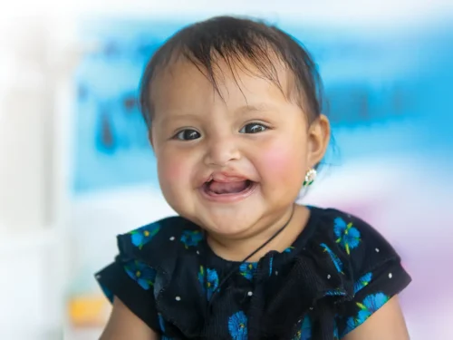 Melida, before her surgery