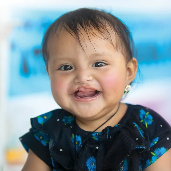 Melida, before her surgery