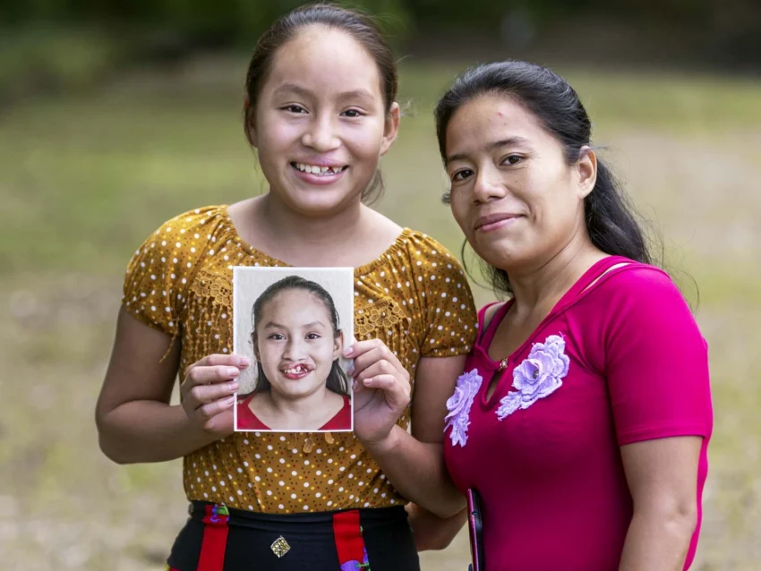A teenage girl smiles as she poses beside her mother while holding a photo of herself before cleft lip surgery.