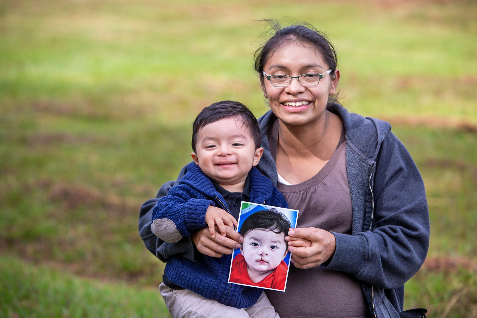 Mosiah Antonio Reyes Lorenzo, after, male, 18 months at Operation Smile’s mission in Guatemala City, Guatemala at Hospital Juan Pablo II in December 2021.