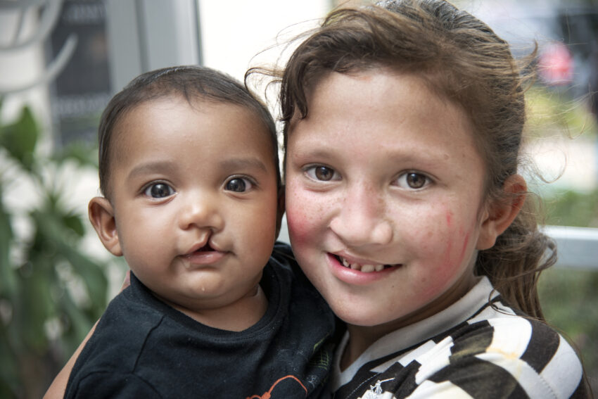 A young child with a cleft lip receives a hug from an older child.