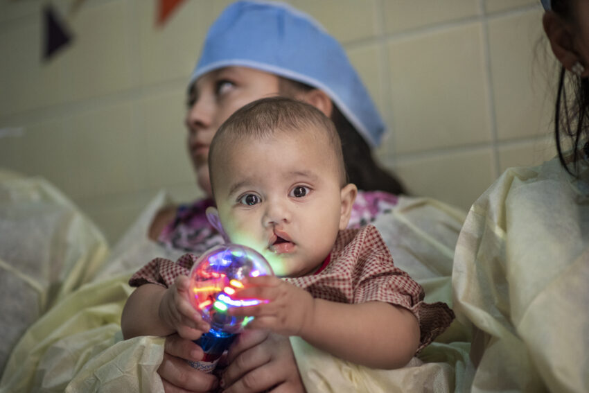 A baby with a cleft lip plays with a light up toy while his mom, who is wearing surgical scrubs, holds him 