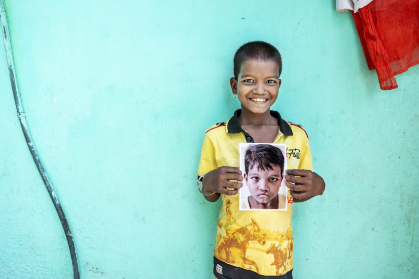 Young boy wearing yellow shirt standing in front of green wall holding picture of his younger self before receiving cleft surgery