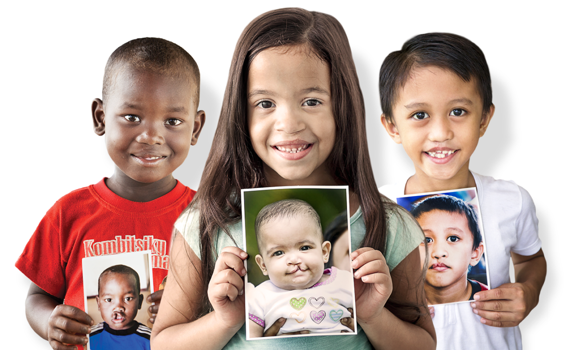 Three children holding their before cleft surgery photos