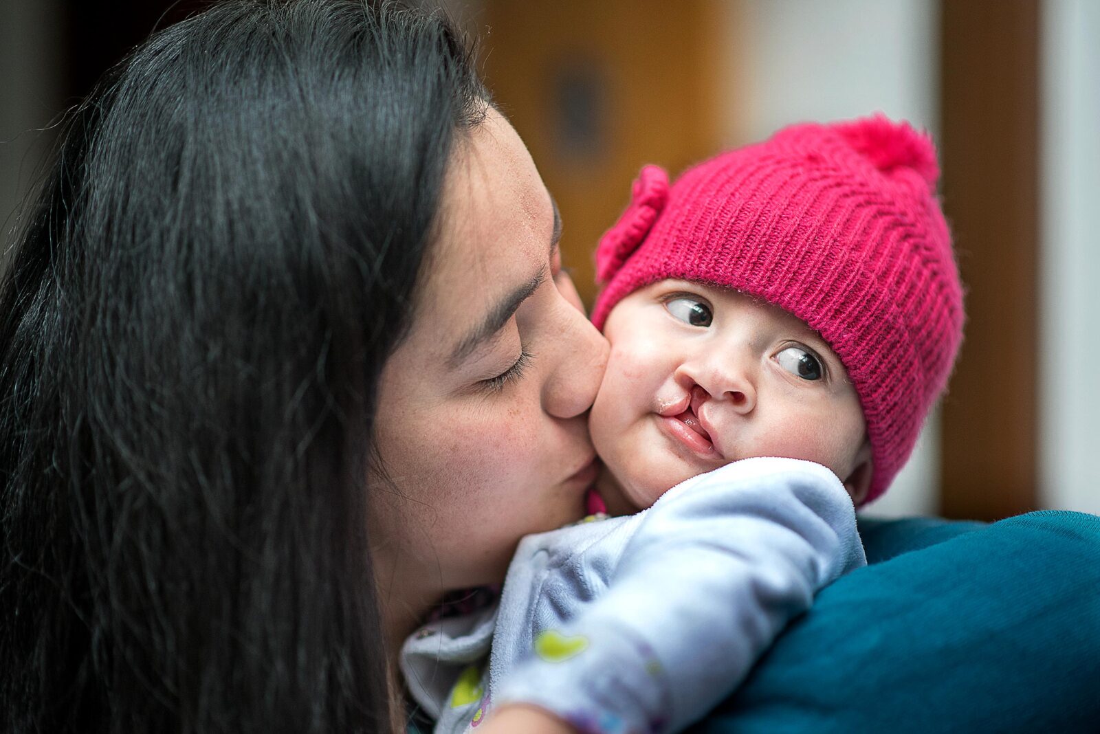 Luciana with her Mother before surgery.