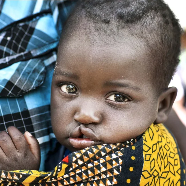 Child from Malawi is being swaddled by their parent.