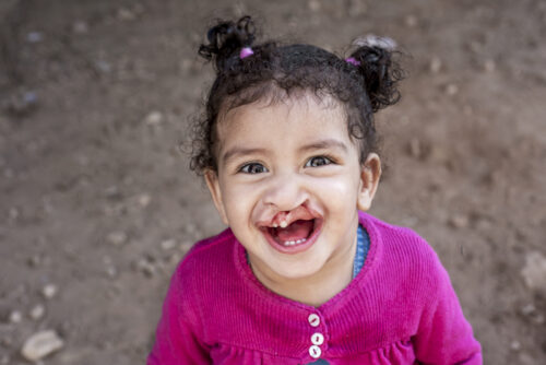 Young girl with a cleft lip is wearing a bright pink sweater and smiling at the camera.