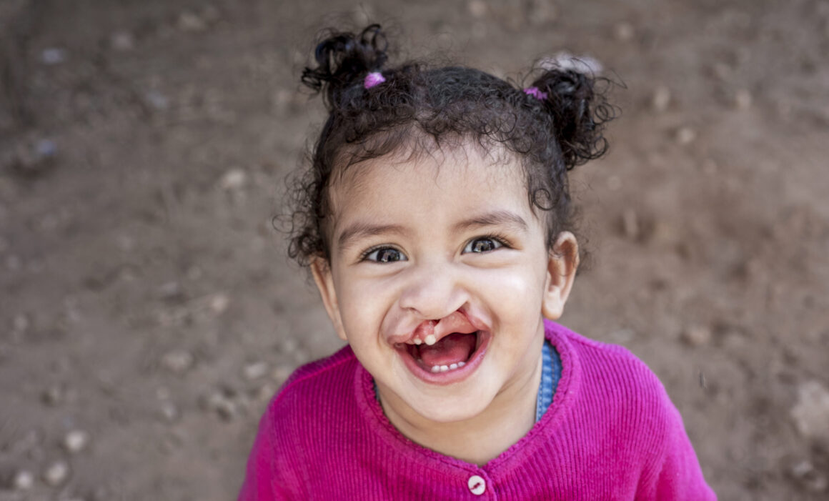 Young girl with a cleft lip is wearing a bright pink sweater and smiling at the camera.