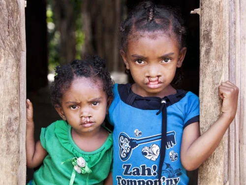 Nambinina, age 2, and Vaviroa, age 6 of Madagascar