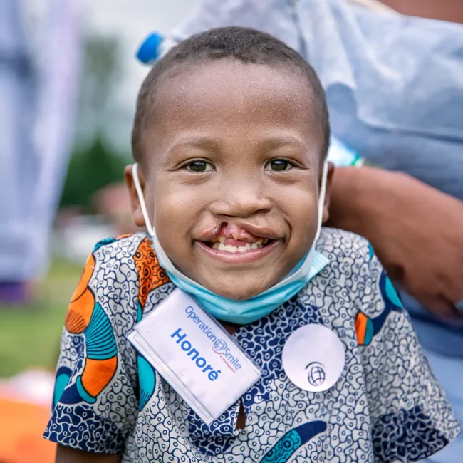 Honoré, 6 years old, before his operation