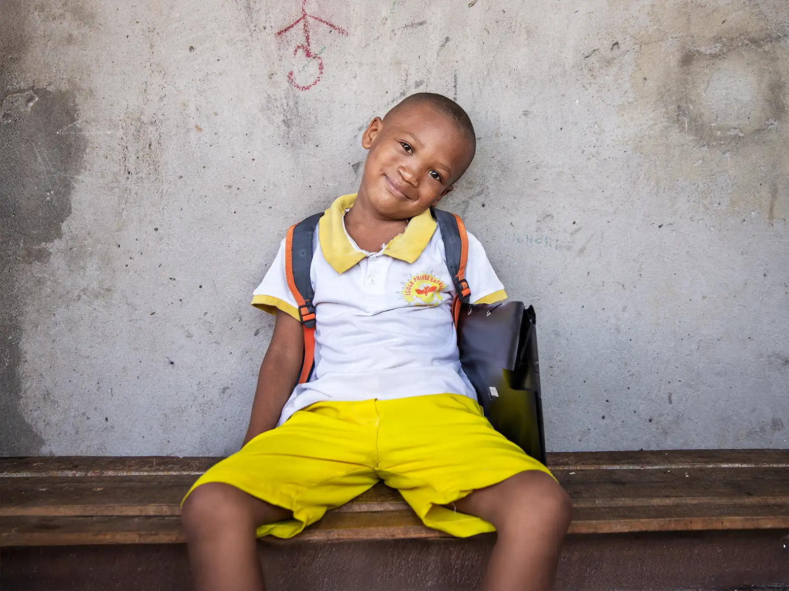 Honoré, 1 year after his operation