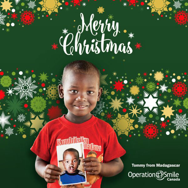 Operation Smile Canada - Every child with a cleft lip or cleft palate ...