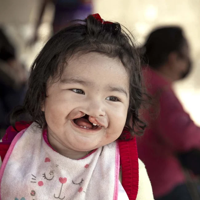 Lilia before surgery, lighting up the room.