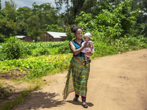 Patricia from Malawi before surgery