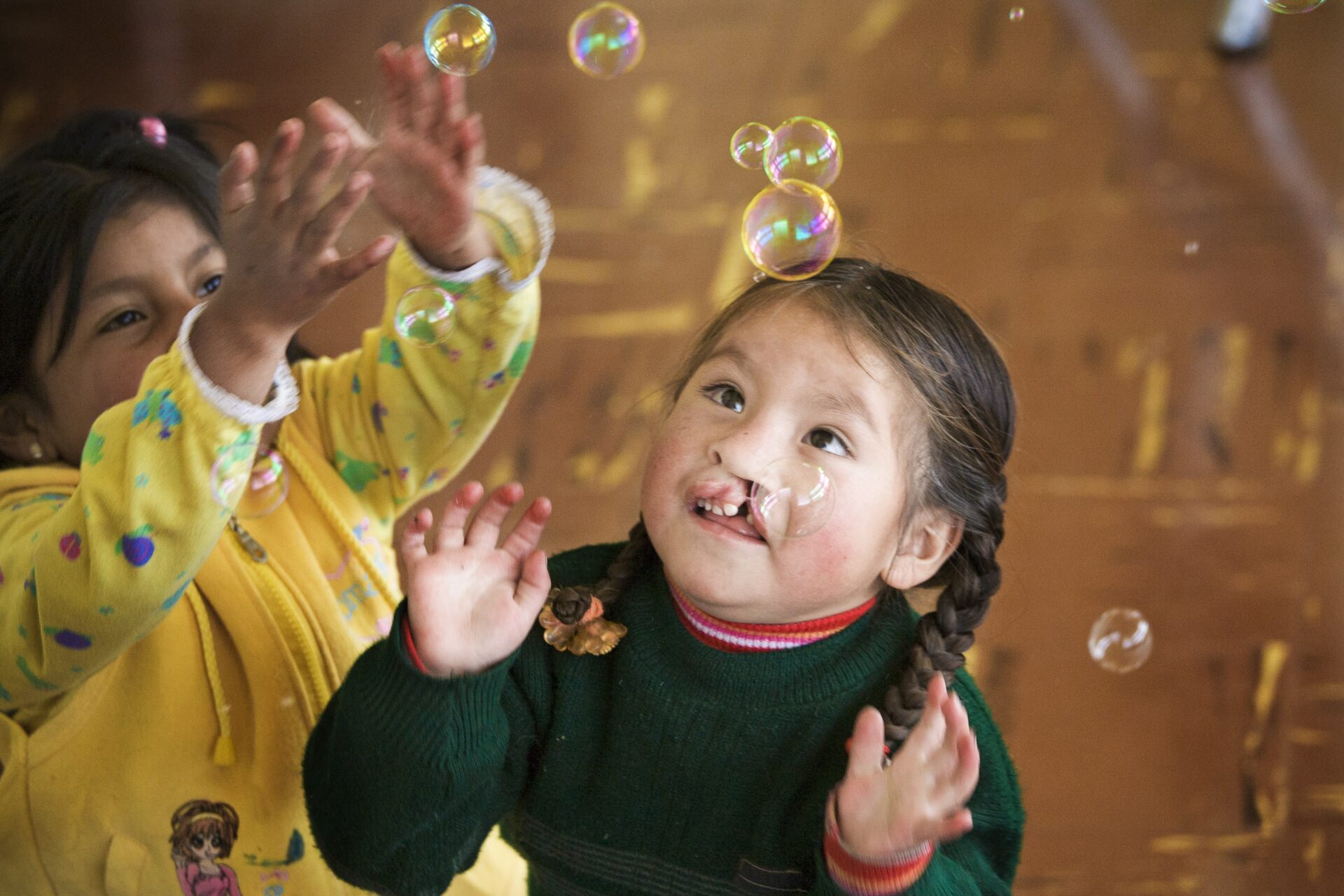 A girl from Peru with a cleft lip tries to blow bubbles