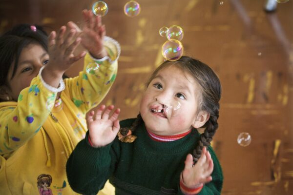 A girl from Peru with a cleft lip tries to blow bubbles