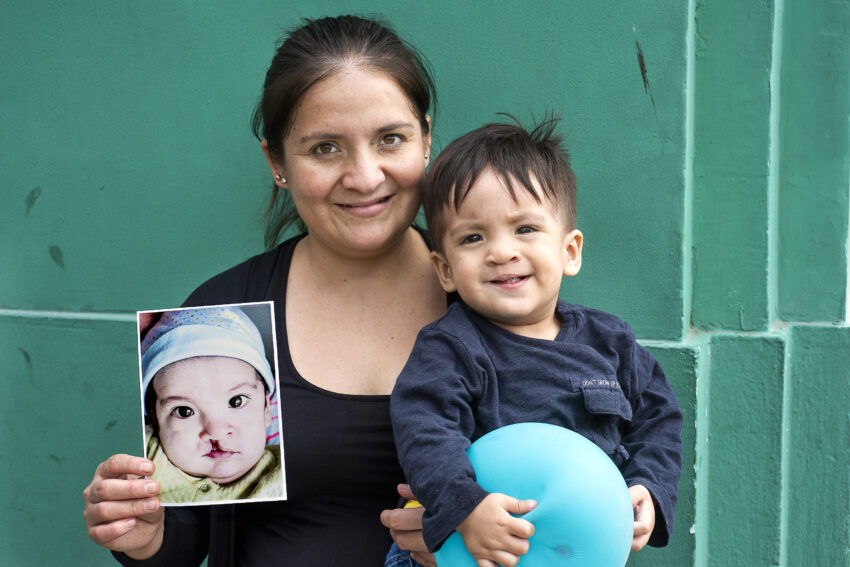 Mother and child smiling while mother holds up photo of child before he received cleft surgery.