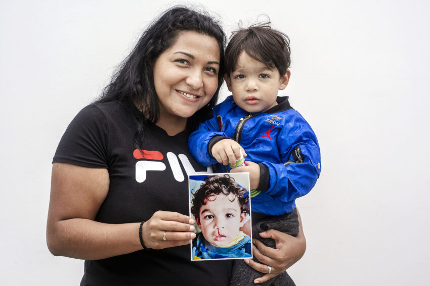 Mother holding her child while showing picture of child before he received cleft surgery