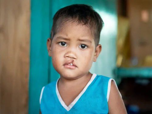 Jupiter, before surgery