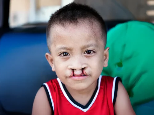Joseph Misa, 6, from the Philippines