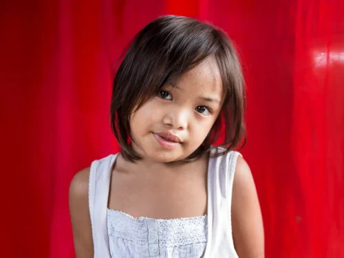 Jane Rose Amoro, 8, After her surgery