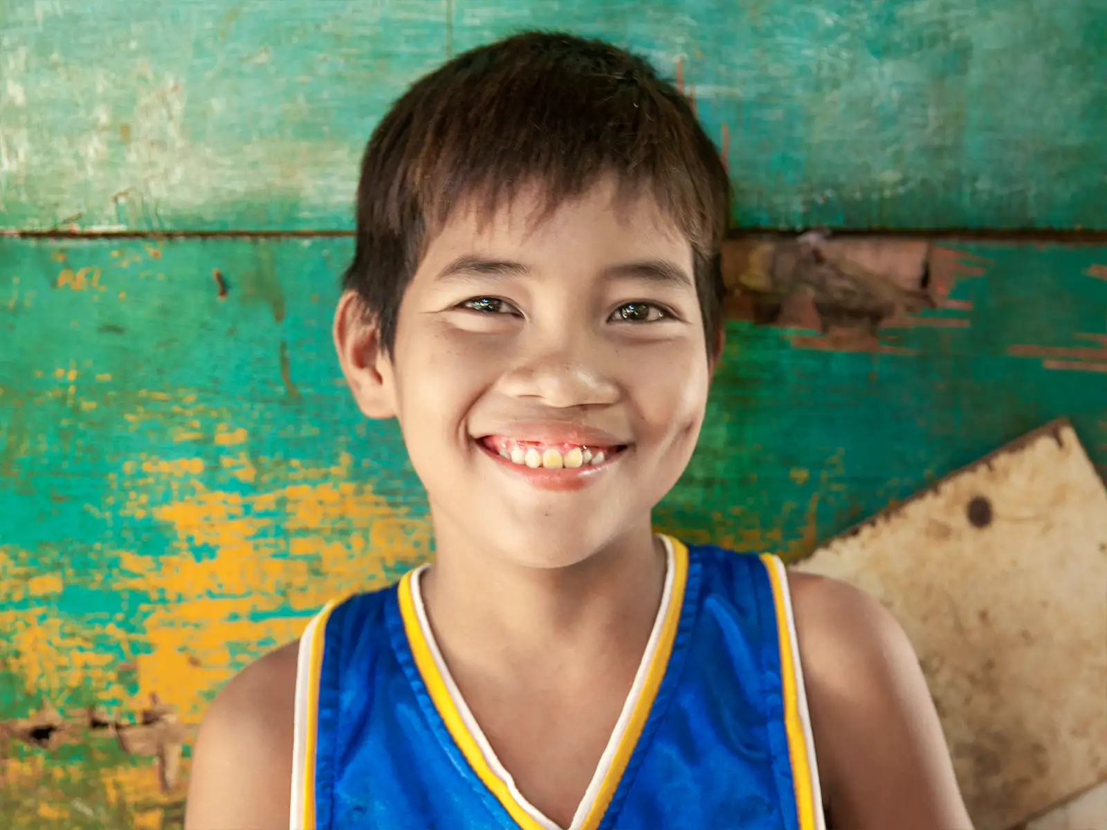 Jupiter, after surgery