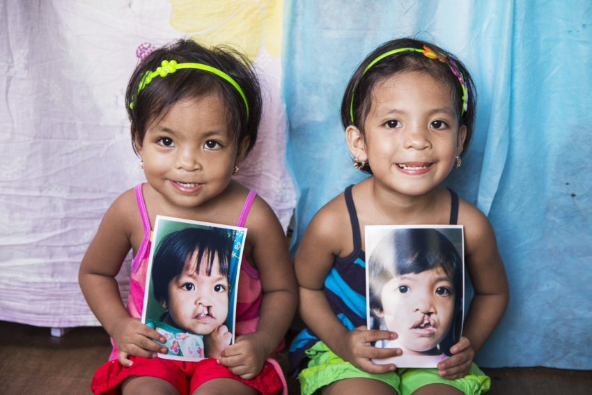 Two young girls sitting while holding photos of themselves before they received cleft surgery.