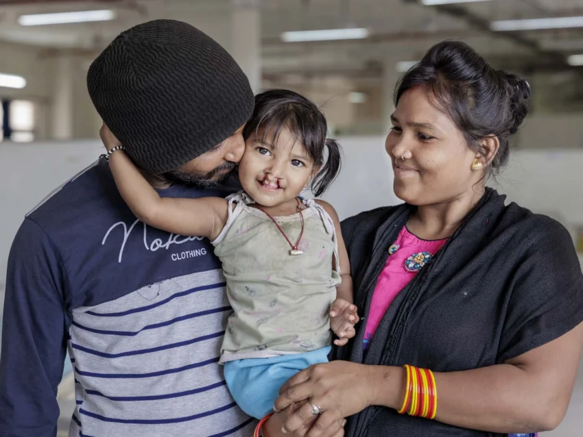 A young girl with a cleft condition hugs her father as her mother looks at her adoringly.