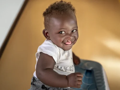 Young child smiling at the camera, his cleft lip visible