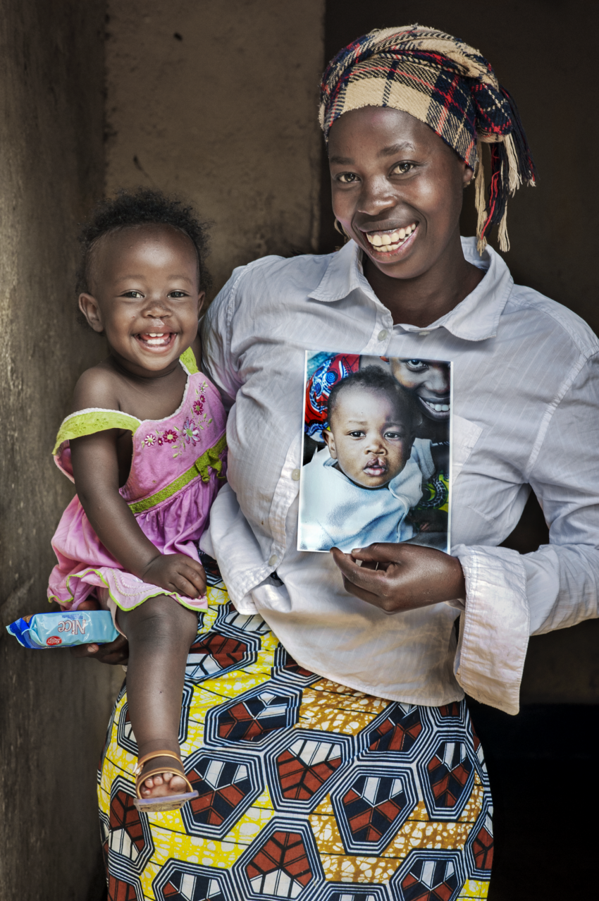 Baby in her mother's arms, holding a photo of herself as a child before receiving cleft surgery