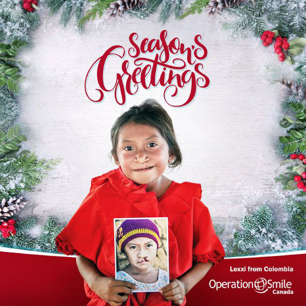 Operation Smile Canada - Every child with a cleft lip or cleft palate ...