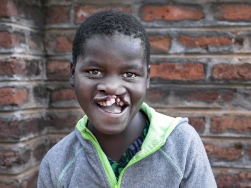 Shakira of Malawi