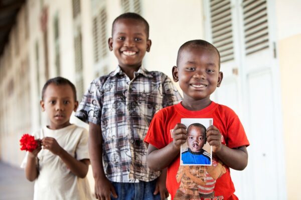 Three young boys stand next to each other. One holds a picture of his younger self with a cleft lip.