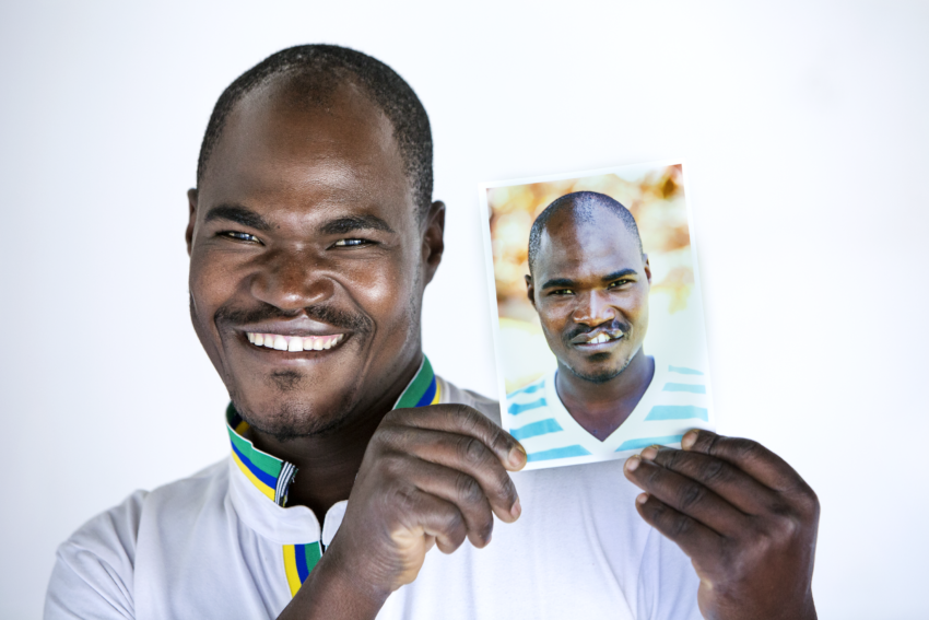 30 years old male, smiles as he holds a photo of his younger self before having cleft surgery in Mbombela, South Africa.